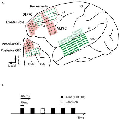 Prediction-Related Frontal-Temporal Network for Omission Mismatch Activity in the Macaque Monkey